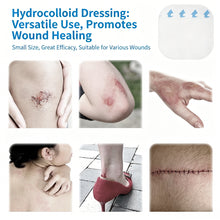 Load image into Gallery viewer, Medical-Grade Hydrocolloid Patch For Wound Care Hydrocolloid Bandages With Self-Adhesive Bed Sore Bandages Highly Absorbent For Burn
