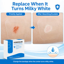 Load image into Gallery viewer, Medical-Grade Hydrocolloid Patch For Wound Care Hydrocolloid Bandages With Self-Adhesive Bed Sore Bandages Highly Absorbent For Burn
