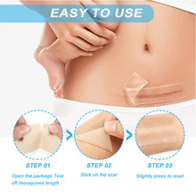 Load image into Gallery viewer, Silicone Self-Adhesive Waterproof Silicone Scar Sheets Covering Patch Waterproof Breathable Body Hand Skin Care Tape
