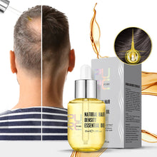Load image into Gallery viewer, Ginger Essence Hair Growth Essential Oil Fast Regrowth Oil Serum Hair Loss Medicine Enhancer Care Beauty Scalp Treatment
