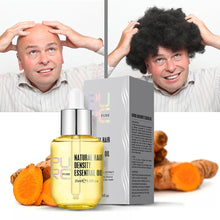 Load image into Gallery viewer, Ginger Essence Hair Growth Essential Oil Fast Regrowth Oil Serum Hair Loss Medicine Enhancer Care Beauty Scalp Treatment
