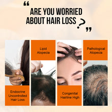 Load image into Gallery viewer, Ginger Essence Hair Growth Essential Oil Fast Regrowth Oil Serum Hair Loss Medicine Enhancer Care Beauty Scalp Treatment
