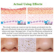 Load image into Gallery viewer, Blackhead Remover Face Nose Mask Pore Strip Black Mask Peeling Acne Treatment Deep Cleansing Mask Oil Control Skin Care
