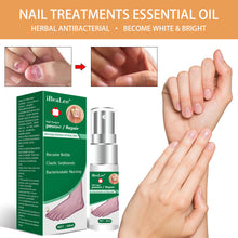 Load image into Gallery viewer, Nail Fungus Anti Infection Feet Care Essence Nails Foot Repair Toe Nail Fungal Treatment Removal Gel Paronychia Onychomycosis
