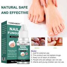 Load image into Gallery viewer, Nail Foot Toe Anti Infection Paronychia Onychomycosis Nail Fungal Treatment Feet Care Essence Nail Fungus Removal Health Care
