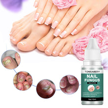 Load image into Gallery viewer, Nail Foot Toe Anti Infection Paronychia Onychomycosis Nail Fungal Treatment Feet Care Essence Nail Fungus Removal Health Care
