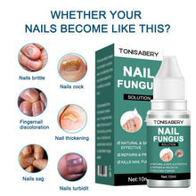 Load image into Gallery viewer, Nail Foot Toe Anti Infection Paronychia Onychomycosis Nail Fungal Treatment Feet Care Essence Nail Fungus Removal Health Care
