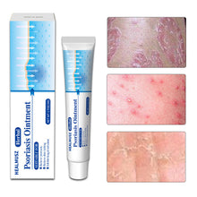 Load image into Gallery viewer, Antibacterial Psoriasis Cream Herbal Effective Relief Dermatitis Eczema Antipruritic Treatment Urticaria Desquamation Skin Care
