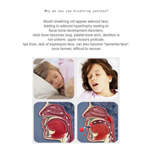 Load image into Gallery viewer, Children Mouth Breathing Correction Stickers Sleep Anti-snoring Artifact Anti-open Mouth Stop Mouth Breathing Sleeping Stickers
