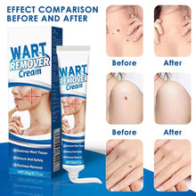Load image into Gallery viewer, Painless Skin Tag Remover Cream Mole Skin Dark Spot Wart Remover Cream Serum Freckle Face Wart Tag Treatment Removal
