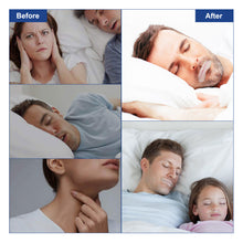 Load image into Gallery viewer, Sleep Strips Mouth Strips Anti Snore Stopper 90Pcs Adhesive Sleep Mouth Tape for Better Nose Breathing Less Mouth Breathing
