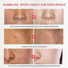 Load image into Gallery viewer, Whitening Freckle Cream Face Moisturizer Remove Dark Spots Melanin Melasma Remover Brightening Skin Repair Anti-Aging
