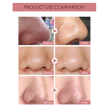 Load image into Gallery viewer, Blackhead Remover Nose Pore Strip Clean Pore Nose Sticker Deep Cleansing Nose Tear-off Nose Pore Strip Skin Care
