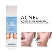 Load image into Gallery viewer, Acne Removal Acne Cream Control Anti-Acne Gel Treatment Lighten Acne Marks Skin Care Whitening Eliminate Pimples Facial Cream
