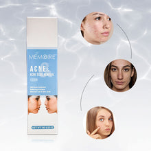 Load image into Gallery viewer, Acne Removal Acne Cream Control Anti-Acne Gel Treatment Lighten Acne Marks Skin Care Whitening Eliminate Pimples Facial Cream

