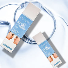 Load image into Gallery viewer, Acne Removal Acne Cream Control Anti-Acne Gel Treatment Lighten Acne Marks Skin Care Whitening Eliminate Pimples Facial Cream
