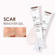 Load image into Gallery viewer, Scar Repair Cream Pimples Acne Scars Remove Gel Fade Stretch Marks Burn Surgical Scars Treatment Serum Smooth Body Skin Care
