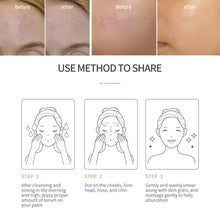 Load image into Gallery viewer, Scar Repair Cream Pimples Acne Scars Remove Gel Fade Stretch Marks Burn Surgical Scars Treatment Serum Smooth Body Skin Care
