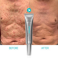 Load image into Gallery viewer, Against Psoriasis Cream Natural Herbal Ointment Antibacterial Gel Anti-Itch Eczematoid Urticaria Psoriasis Skin Care Cream
