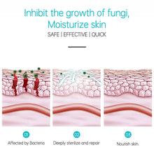 Load image into Gallery viewer, Against Psoriasis Cream Natural Herbal Ointment Antibacterial Gel Anti-Itch Eczematoid Urticaria Psoriasis Skin Care Cream
