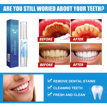 Load image into Gallery viewer, Teeth Cleaning Pen Oral Cleaning Teeth Whitening Pen Remove Stains Teeth Cleaning Pen Oral Hygiene Care
