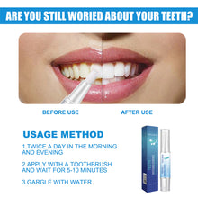 Load image into Gallery viewer, Teeth Cleaning Pen Oral Cleaning Teeth Whitening Pen Remove Stains Teeth Cleaning Pen Oral Hygiene Care
