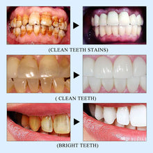 Load image into Gallery viewer, Tooth Whitening Pen Remove Plaque and Tartar Clean Mouth Tooth Brushing Essence Teeth Whitening Pen Teeth Tooth Brush
