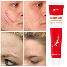 Load image into Gallery viewer, Scar Repair Cream Acne Remove Gel Acne Pits Acne Scars Spots Surgical Scars Treatment Repair Cream Smooth Body Skin Care
