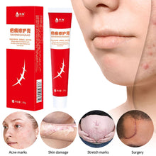 Load image into Gallery viewer, Scar Repair Cream Acne Remove Gel Acne Pits Acne Scars Spots Surgical Scars Treatment Repair Cream Smooth Body Skin Care
