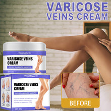 Load image into Gallery viewer, Leg Repair Cream Varicose Legs Earthworms Blue Veins Protruding Pain Pulse Health Leg Care Vasculitis Ointment Veins Relief Cream
