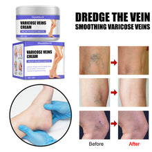 Load image into Gallery viewer, Leg Repair Cream Varicose Legs Earthworms Blue Veins Protruding Pain Pulse Health Leg Care Vasculitis Ointment Veins Relief Cream

