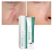 Load image into Gallery viewer, Scar Remover Cream Stretch Acne Treatment Scars Removal Skin Repair Cream Whitening Dark Spot Remover Cream Face Skin Care
