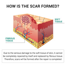 Load image into Gallery viewer, Scar Remover Cream Stretch Acne Treatment Scars Removal Skin Repair Cream Whitening Dark Spot Remover Cream Face Skin Care
