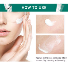 Load image into Gallery viewer, Scar Remover Cream Stretch Acne Treatment Scars Removal Skin Repair Cream Whitening Dark Spot Remover Cream Face Skin Care
