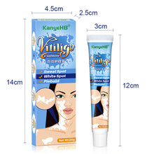 Load image into Gallery viewer, Herbal Extract Vitiligo Ointment Remove Ringworm White Spot Removal Skin White Spot Leukoplakia Disease Treatment Cream
