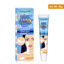 Load image into Gallery viewer, Herbal Extract Vitiligo Ointment Remove Ringworm White Spot Removal Skin White Spot Leukoplakia Disease Treatment Cream
