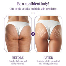 Load image into Gallery viewer, Butt Peach Buttock Whitening Cream Acne Clearing Treatment Spot Brighten Skin cream Skin Care for Buttocks Thigh Beauty Health Care
