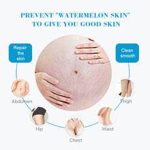 Load image into Gallery viewer, Stretch Mark Repair Cream Moisturize Firm Skin Removal Growth Striation Stretch Mark Body Repair Cream
