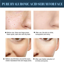 Load image into Gallery viewer, Protein Lifting Line Lift Tighten Facial Contour Reduce Facial Fine Lines Repairing Moisturizing Facial Protein Line Skin Care
