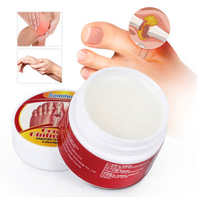Load image into Gallery viewer, Gout Care Cream Pain Relief Ointment Toe Joint Valgus Corrector Cream Thumb Hallux Arthritis Pain Relief Toe Knee Joint Pain Cream
