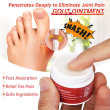 Load image into Gallery viewer, Gout Care Cream Pain Relief Ointment Toe Joint Valgus Corrector Cream Thumb Hallux Arthritis Pain Relief Toe Knee Joint Pain Cream
