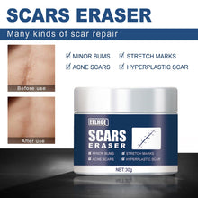 Load image into Gallery viewer, Skin Scar Gel Cream Cold Compress Burn Scar Cream Fade Surgical Scar Repair Cream Effective Acne Scar Removal Cream
