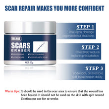 Load image into Gallery viewer, Skin Scar Gel Cream Cold Compress Burn Scar Cream Fade Surgical Scar Repair Cream Effective Acne Scar Removal Cream
