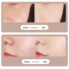 Load image into Gallery viewer, Skin Tag Remover 15 Levels Laser Plasma Pen Freckle Mole Warts Removal Lcd Nevus Tattoo Black Spots Remover Blemish Removal

