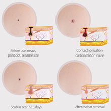 Load image into Gallery viewer, Skin Tag Remover 15 Levels Laser Plasma Pen Freckle Mole Warts Removal Lcd Nevus Tattoo Black Spots Remover Blemish Removal
