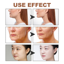 Load image into Gallery viewer, Facial Myofascial Lift Tape Anti Sagging Face Lifting Tightening Face Lifting Tape Breathable Face Lifter Paste

