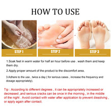 Load image into Gallery viewer, Cracked Skin Banana Repair Cream Foot Crack Prevention Repair Moisturize Anti-chapped Cream Hand Foot Care
