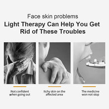 Load image into Gallery viewer, Ultraviolet Phototherapy Instrument Psoriasis Vitiligo Rose Bran Psoriasis Eczema Beauty Instrument Light Therapy Instrument
