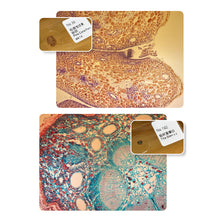 Load image into Gallery viewer, 400X Microscope Phone Lens Case Kit for iphone 12 Pro MAX 11 pro max Bulit-in Light Lens Tinyscope Kit Tipscope
