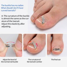 Load image into Gallery viewer, Professional Pedicure Recover Embed Toe Nail Treatment Ingrown Toenail Corrector Tools Onychia Lateralis Correction Foot Care Tool
